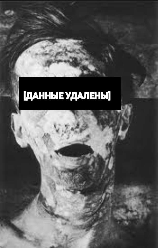 SCP-106-1