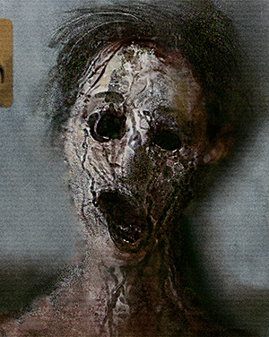 SCP-106-1 - Выжившие жертвы
